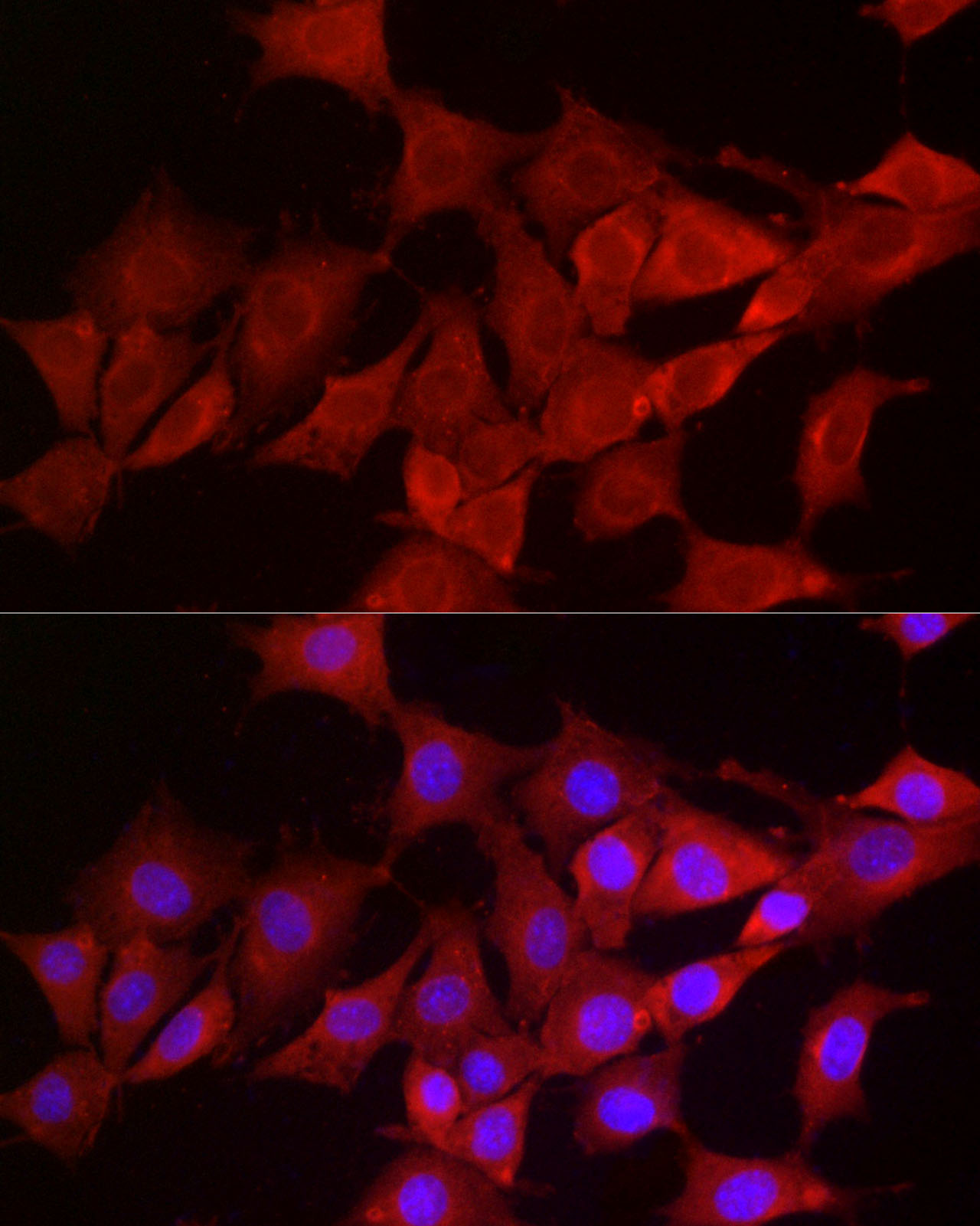 Immunofluorescence analysis of NIH/3T3 cells using SMG1 Polyclonal Antibody atdilution of 1:200 (40x lens). Blue: DAPI for nuclear staining.