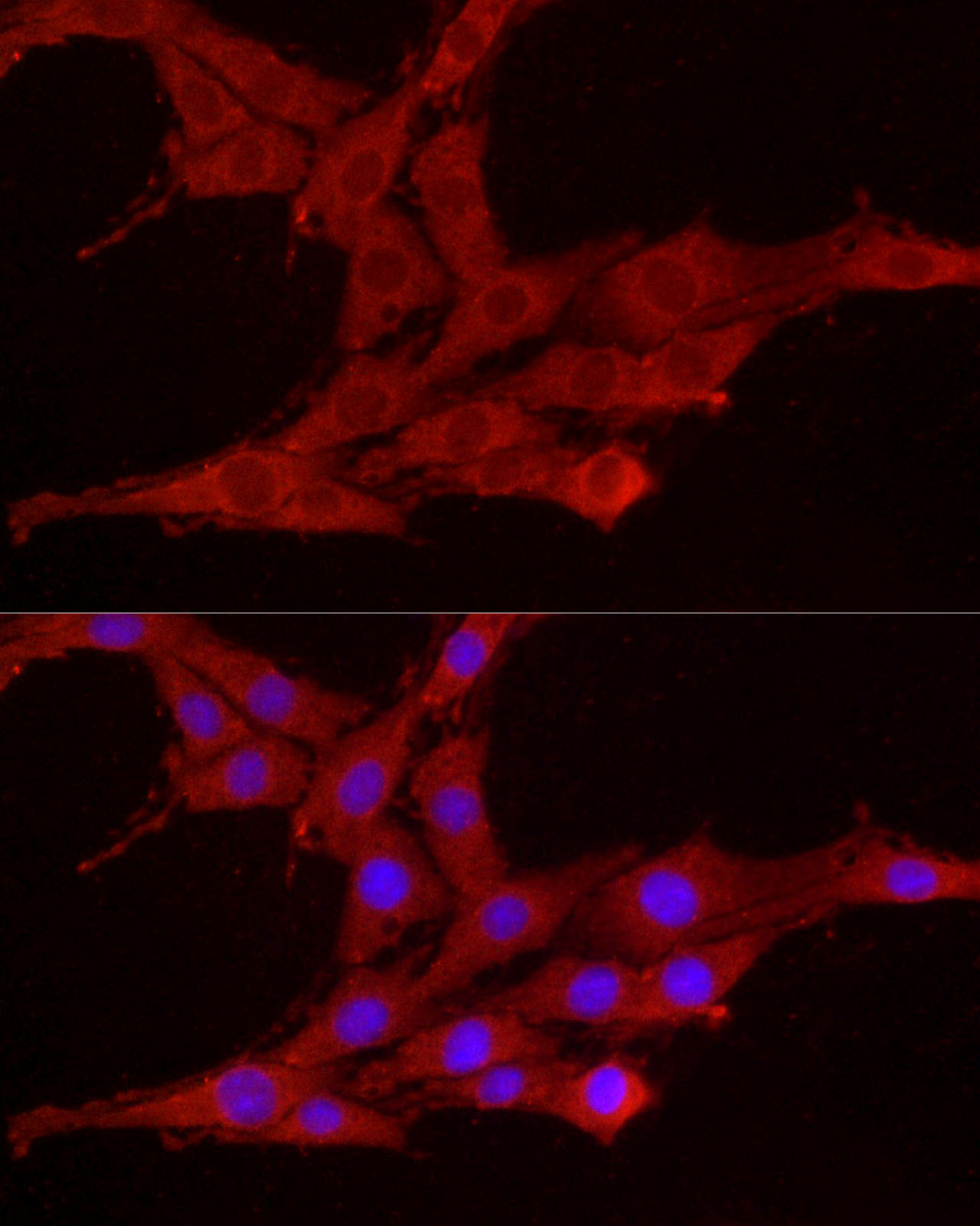 Immunofluorescence analysis of PC-12 cells using SMG1 Polyclonal Antibody at dilution of 1:200 (40x lens). Blue: DAPI for nuclear staining.