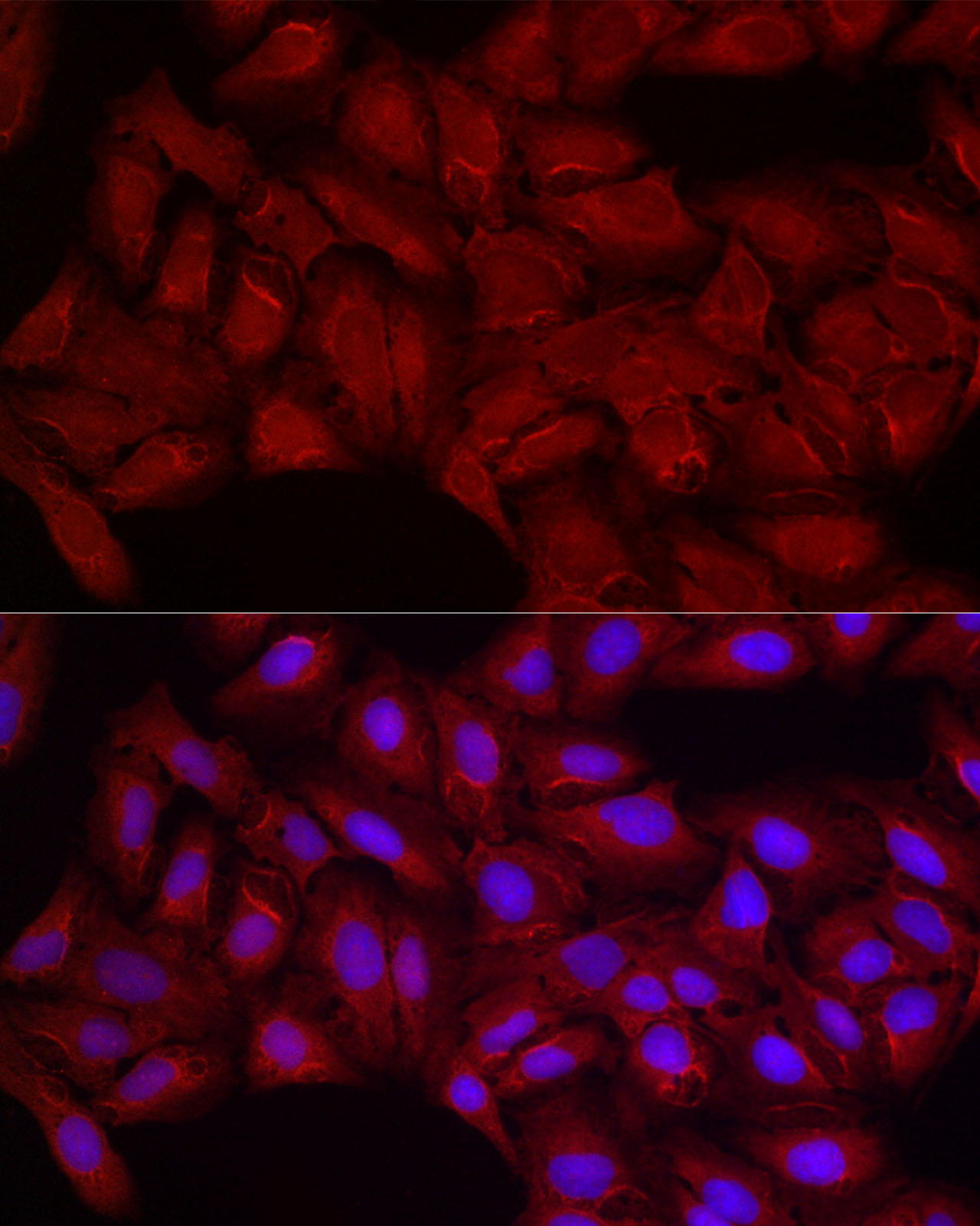 Immunofluorescence analysis of U2OS cells using SMG1 Polyclonal Antibody at dilution of 1:200 (40x lens). Blue: DAPI for nuclear staining.