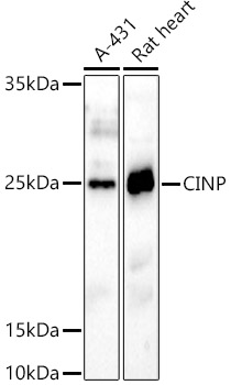 Western blot analysis of extracts of various cell lines using CINP Polyclonal Antibody at 1:1000 dilution.