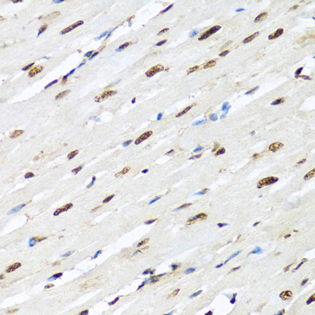 Immunohistochemistry of paraffin-embedded rat heart using HNRNPR Polyclonal Antibody at dilution of 1:100 (40x lens).Perform microwave antigen retrieval with 10 mM PBS buffer pH 7.2 before commencing with IHC staining protocol.