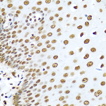 Immunohistochemistry of paraffin-embedded human esophagus using HNRNPR Polyclonal Antibody at dilution of 1:100 (40x lens).Perform microwave antigen retrieval with 10 mM PBS buffer pH 7.2 before commencing with IHC staining protocol.