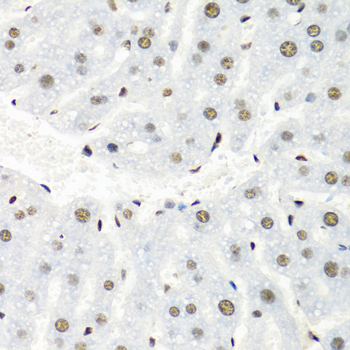 Immunohistochemistry of paraffin-embedded mouse liver using HNRNPR Polyclonal Antibody at dilution of 1:100 (40x lens).Perform microwave antigen retrieval with 10 mM PBS buffer pH 7.2 before commencing with IHC staining protocol.