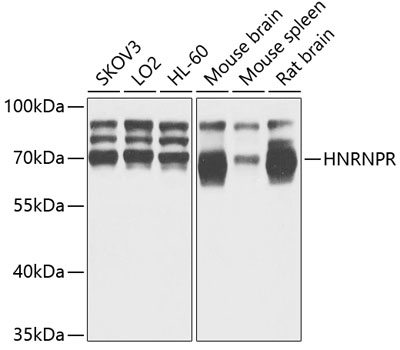 Western blot analysis of extracts of various cell lines using HNRNPR Polyclonal Antibody at 1:1000 dilution.