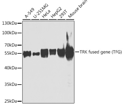 Western blot analysis of extracts of various cell lines using TRK fused gene Polyclonal Antibody at1:1000 dilution.