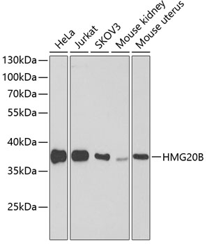 Western blot analysis of extracts of various cell lines using HMG20B Polyclonal Antibody at 1:1000 dilution.