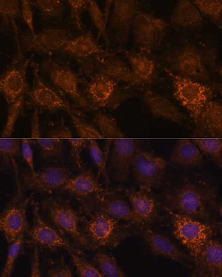 Immunofluorescence analysis of C6 cells using HIBADH Polyclonal Antibody at dilution of 1:100. Blue: DAPI for nuclear staining.