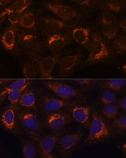 Immunofluorescence analysis of U2OS cells using HIBADH Polyclonal Antibody at dilution of 1:100. Blue: DAPI for nuclear staining.