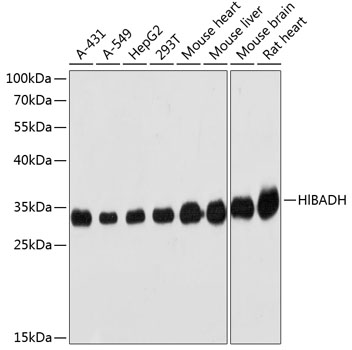 Western blot analysis of extracts of various cell lines using HIBADH Polyclonal Antibody at 1:3000 dilution.