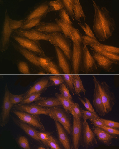 Immunofluorescence analysis of H9C2 cells using [KO Validated] STRAP Polyclonal Antibody at dilution of 100 (40x lens). Blue: DAPI for nuclear staining.