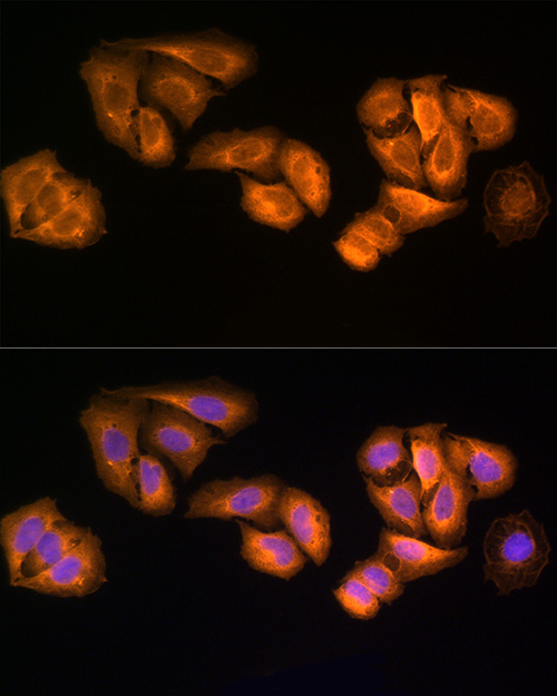 Immunofluorescence analysis of U2OS cells using [KO Validated] STRAP Polyclonal Antibody at dilution of 100 (40x lens). Blue: DAPI for nuclear staining.