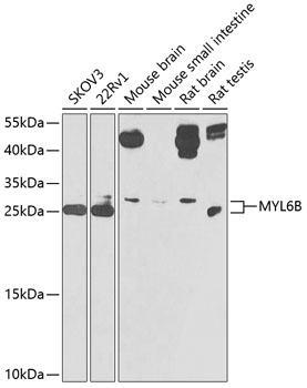 Western blot analysis of extracts of various cell lines using MYL6B Polyclonal Antibody at 1:1000 dilution.