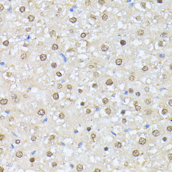 Immunohistochemistry of paraffin-embedded rat liver using Casein Kinase 2 alpha Polyclonal Antibody at dilution of 1:100 (40x lens).Perform microwave antigen retrieval with 10 mM PBS buffer pH 7.2 before commencing with IHC staining protocol.