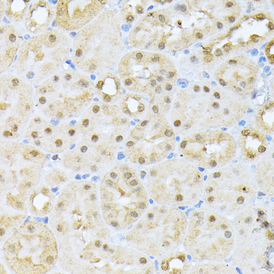 Immunohistochemistry of paraffin-embedded mouse kidney using Casein Kinase 2 alpha Polyclonal Antibody at dilution of 1:100 (40x lens).Perform microwave antigen retrieval with 10 mM PBS buffer pH 7.2 before commencing with IHC staining protocol.