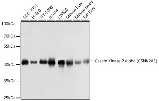 Western blot analysis of extracts of various cell lines using Casein Kinase 2 alpha Polyclonal Antibody at1:1000 dilution.