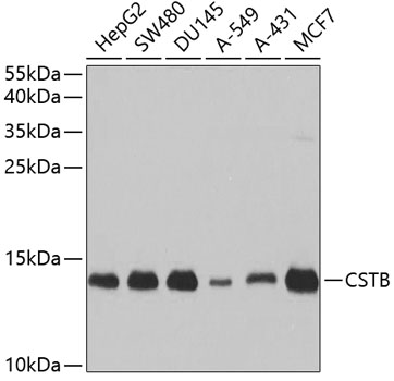 Western blot analysis of extracts of various cell lines using CSTB Polyclonal Antibody at 1:1000 dilution.