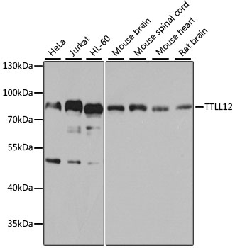 Western blot analysis of extracts of various cell lines using TTLL12 Polyclonal Antibody at 1:1000 dilution.