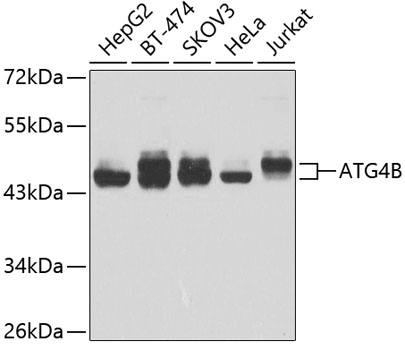 Western blot analysis of extracts of various cell lines using ATG4B Polyclonal Antibody at 1:1000 dilution.