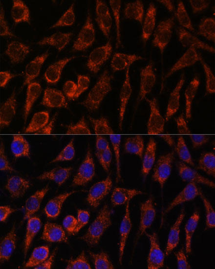 Immunofluorescence analysis of L929 cells using NUP210 Polyclonal Antibody at dilution of 1:100. Blue: DAPI for nuclear staining.