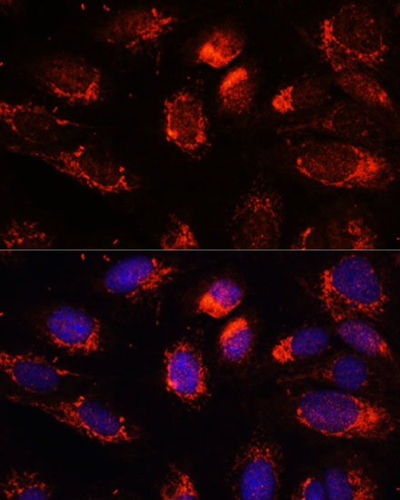 Immunofluorescence analysis of U2OS cells using NUP210 Polyclonal Antibody at dilution of 1:100. Blue: DAPI for nuclear staining.