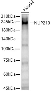 Western blot analysis of HepG2 using NUP210 Polyclonal Antibody at 1:1000 dilution.