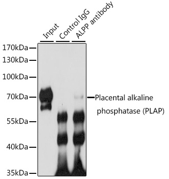 Immunoprecipitation analysis of 200ug extracts of HeLa cells using 3 ug Placental alkaline phosphatase (PLAP) Polyclonal Antibody. Western blot was performed from the immunoprecipitate using Placental alkaline phosphatase (PLAP) Polyclonal Antibody at a dilution of 1:1000.