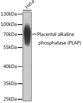 Western blot analysis of extracts of HeLa cells using Placental alkaline phosphatase Polyclonal Antibody at1:1000 dilution.