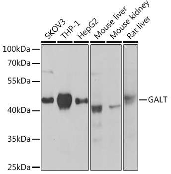 Western blot analysis of extracts of various cell lines using GALT Polyclonal Antibody at1:1000 dilution.