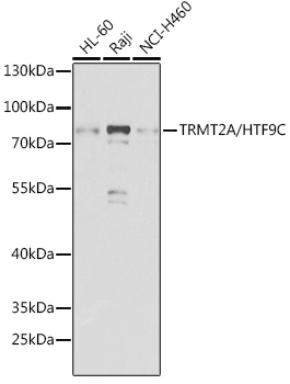 Western blot analysis of extracts of various cell lines using TRMT2A/HTF9C Polyclonal Antibody at 1:1000 dilution.