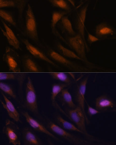 Immunofluorescence analysis of U2OS cells using UBE2S Polyclonal Antibody at dilution of 1:100. Blue: DAPI for nuclear staining.