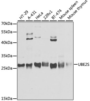 Western blot analysis of extracts of various cell lines using UBE2S Polyclonal Antibody at 1:3000 dilution.