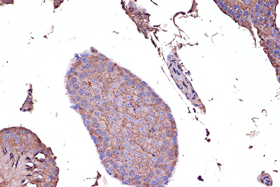 Immunohistochemistry of paraffin-embedded Mouse testis using PD-L1/CD274 Polyclonal Antibody at dilution of 1:100 (40x lens).Perform microwave antigen retrieval with 10 mM PBS buffer pH 7.2 before commencing with IHC staining protocol.