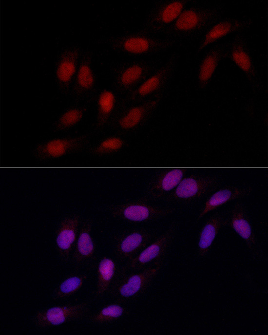 Immunofluorescence analysis of U2OS cells using MSH6 Polyclonal Antibody at dilution of 1:200 (40x lens). Blue: DAPI for nuclear staining.