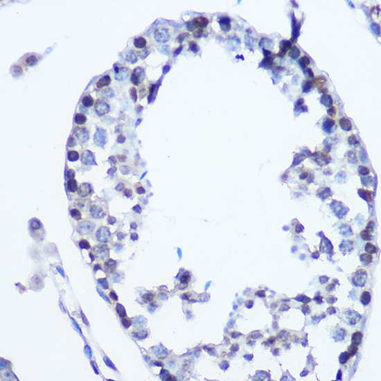 Immunohistochemistry of paraffin-embedded mouse testis using MSH6 Polyclonal Antibody at dilution of 1:100 (40x lens).Perform microwave antigen retrieval with 10 mM Tris/EDTA buffer pH 9.0 before commencing with IHC staining protocol.