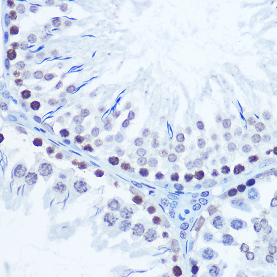 Immunohistochemistry of paraffin-embedded rat testis using MSH6 Polyclonal Antibody at dilution of 1:100 (40x lens).Perform microwave antigen retrieval with 10 mM Tris/EDTA buffer pH 9.0 before commencing with IHC staining protocol.