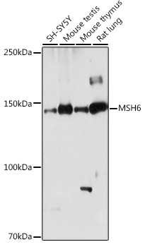 Western blot analysis of extracts of various cell lines using MSH6 Polyclonal Antibody at 1:1000 dilution.
