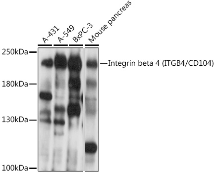 Western blot analysis of extracts of various cell lines using Integrin beta 4 Polyclonal Antibody at1:1000 dilution.