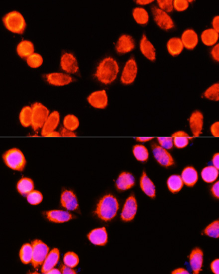 Immunofluorescence analysis of Hela cells using GSTK1 Polyclonal Antibody at dilution of 1:100 (40x lens). Blue: DAPI for nuclear staining.