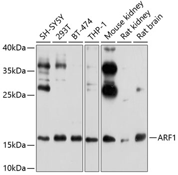 Western blot analysis of extracts of various cell lines using ARF1 Polyclonal Antibody at 1:1000 dilution.