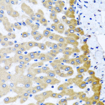 Immunohistochemistry of paraffin-embedded human liver damage using M6PR Polyclonal Antibody at dilution of 1:100 (40x lens).Perform microwave antigen retrieval with 10 mM PBS buffer pH 7.2 before commencing with IHC staining protocol.