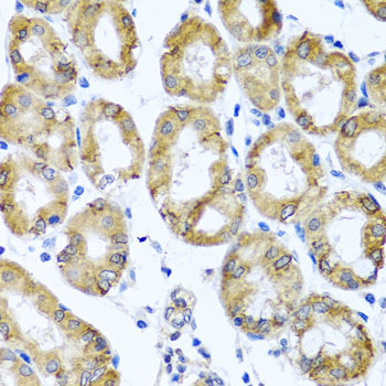 Immunohistochemistry of paraffin-embedded human stomach using M6PR Polyclonal Antibody at dilution of 1:100 (40x lens).Perform microwave antigen retrieval with 10 mM PBS buffer pH 7.2 before commencing with IHC staining protocol.