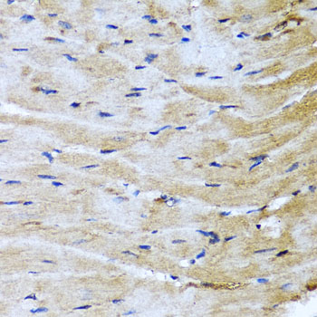 Immunohistochemistry of paraffin-embedded mouse heart using M6PR Polyclonal Antibody at dilution of 1:100 (40x lens).Perform microwave antigen retrieval with 10 mM PBS buffer pH 7.2 before commencing with IHC staining protocol.