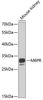 Western blot analysis of extracts of mouse kidney using M6PR Polyclonal Antibody at 1:1000 dilution.