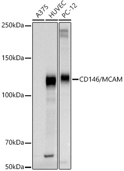 Western blot analysis of extracts of various cell lines using CD146/MCAM Polyclonal Antibody at 1:1000 dilution.