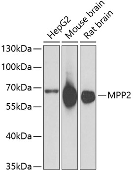 Western blot analysis of extracts of various cell lines using MPP2 Polyclonal Antibody at 1:1000 dilution.