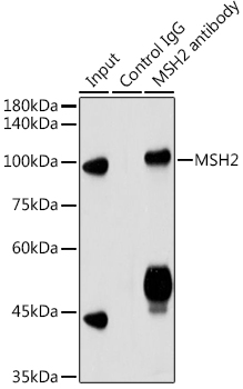 Immunoprecipitation analysis of 300ug extracts of HeLa cells using 3ug MSH2 Polyclonal Antibody. Western blot was performed from the immunoprecipitate using MSH2 Polyclonal Antibody at a dilution of 1:3000.