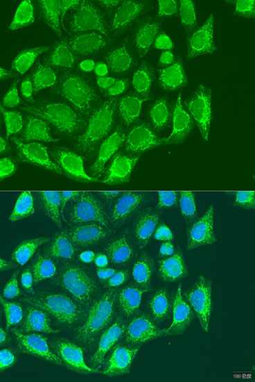 Immunofluorescence analysis of U2OS cells using MTX1 Polyclonal Antibody at dilution of 1:100. Blue: DAPI for nuclear staining.