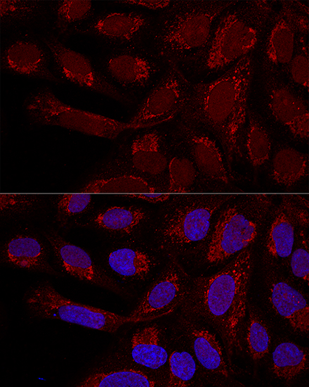 Confocal immunofluorescence analysis of U2OS cells using MTX1 Polyclonal Antibody at dilution of 1:100. Blue: DAPI for nuclear staining.