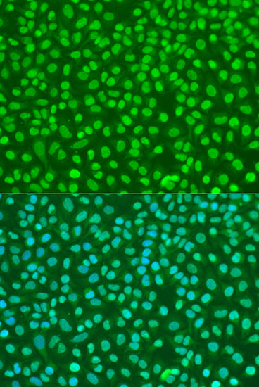 Immunofluorescence analysis of U2OS cells using NBS1/NBS1/NBN Polyclonal Antibody at dilution of 1:100. Blue: DAPI for nuclear staining.