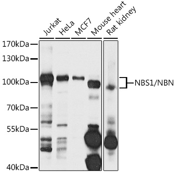 Western blot analysis of extracts of various cell lines using NBS1/NBS1/NBN Polyclonal Antibody at 1:1000 dilution.